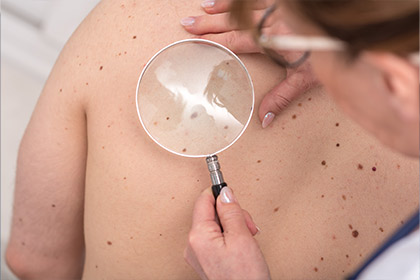 photo d'un dermatologue avec un patient